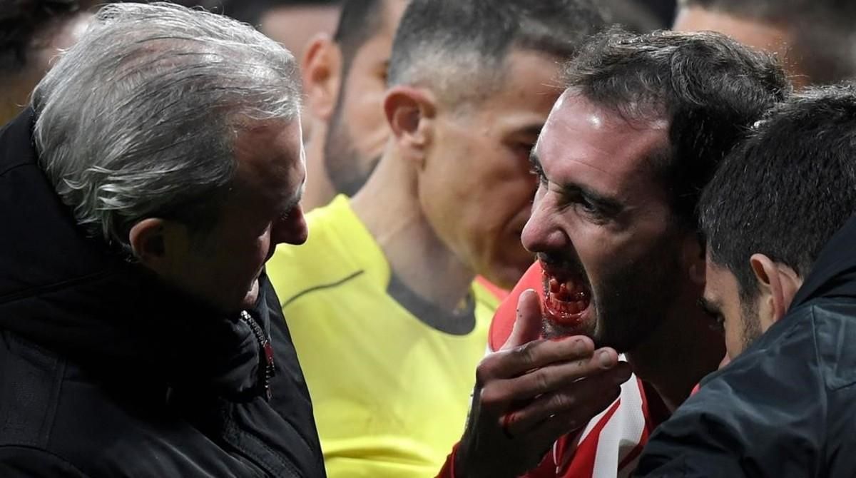 Godín le muestra al doctor del Atlético su boca donde le faltan los tres dientes que acaba de perder en un encontronazo con el meta valencianista Neto. Godín le muestra al doctor del Atlético su boca donde le faltan los tres dientes que acaba de perder en un encontronazo con el meta valencianista Neto.