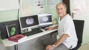 Francisco Guarner, digestólogo del Hospital Vall d’Hebron, muestra unos TAC donde se ve el intestino de un paciente.