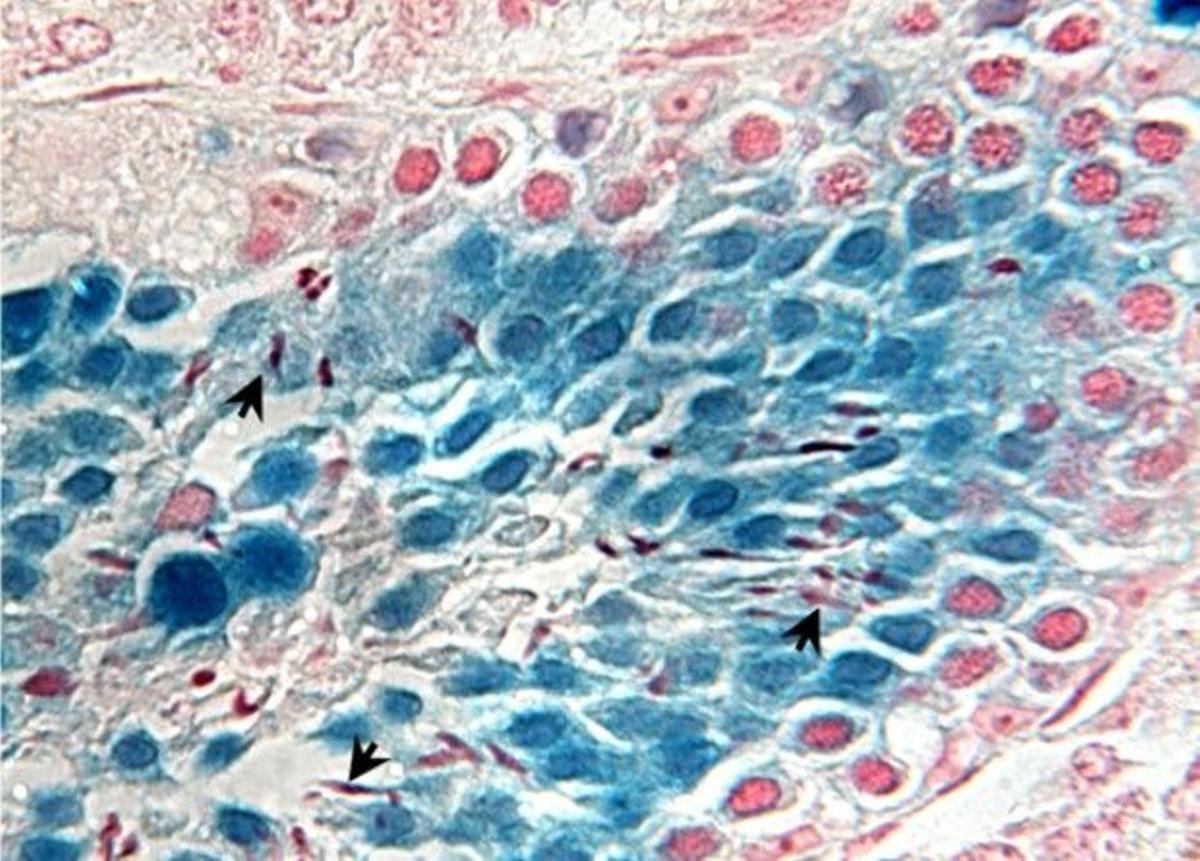 El tejido testicular congelado puede producir espermatozoides viables después de 20 años