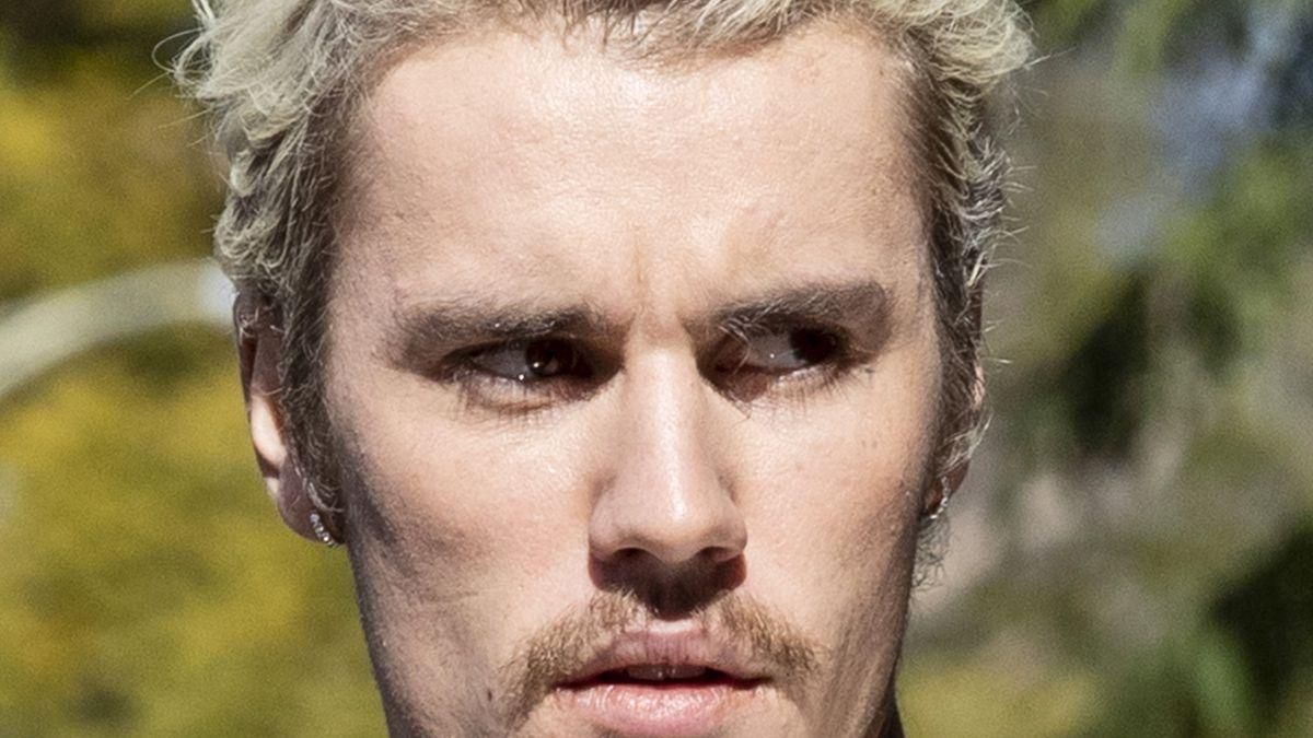 ¿Qué es el síndrome de Ramsay Hunt que paraliza la cara a Justin Bieber? ¿Qué es el síndrome de Ramsay Hunt que paraliza la cara a Justin Bieber?