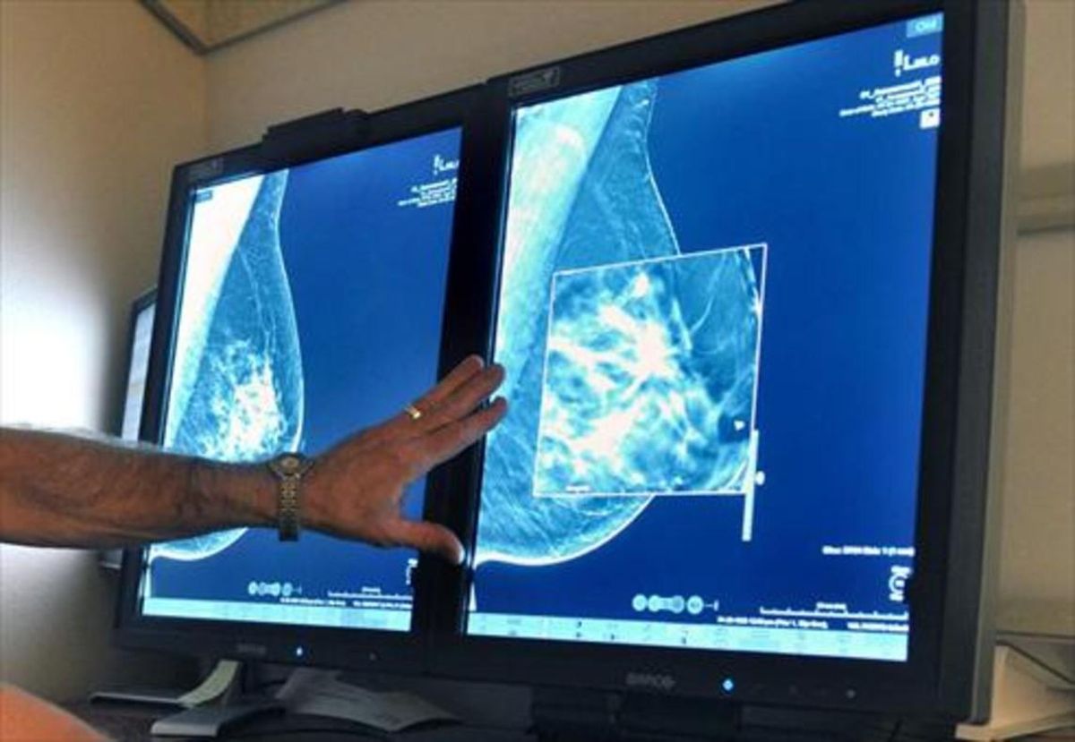 Un radiólogo compara dos mamografías para detectar tumores. Un radiólogo compara dos mamografías para detectar tumores.