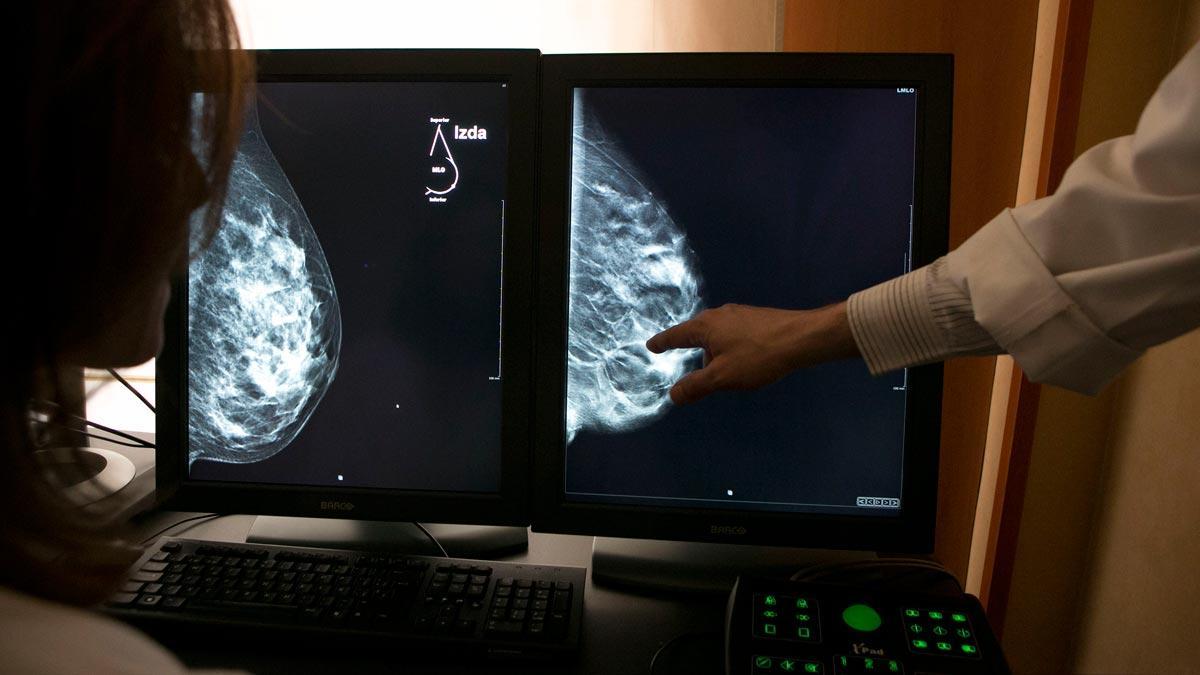 Unas mamografías.