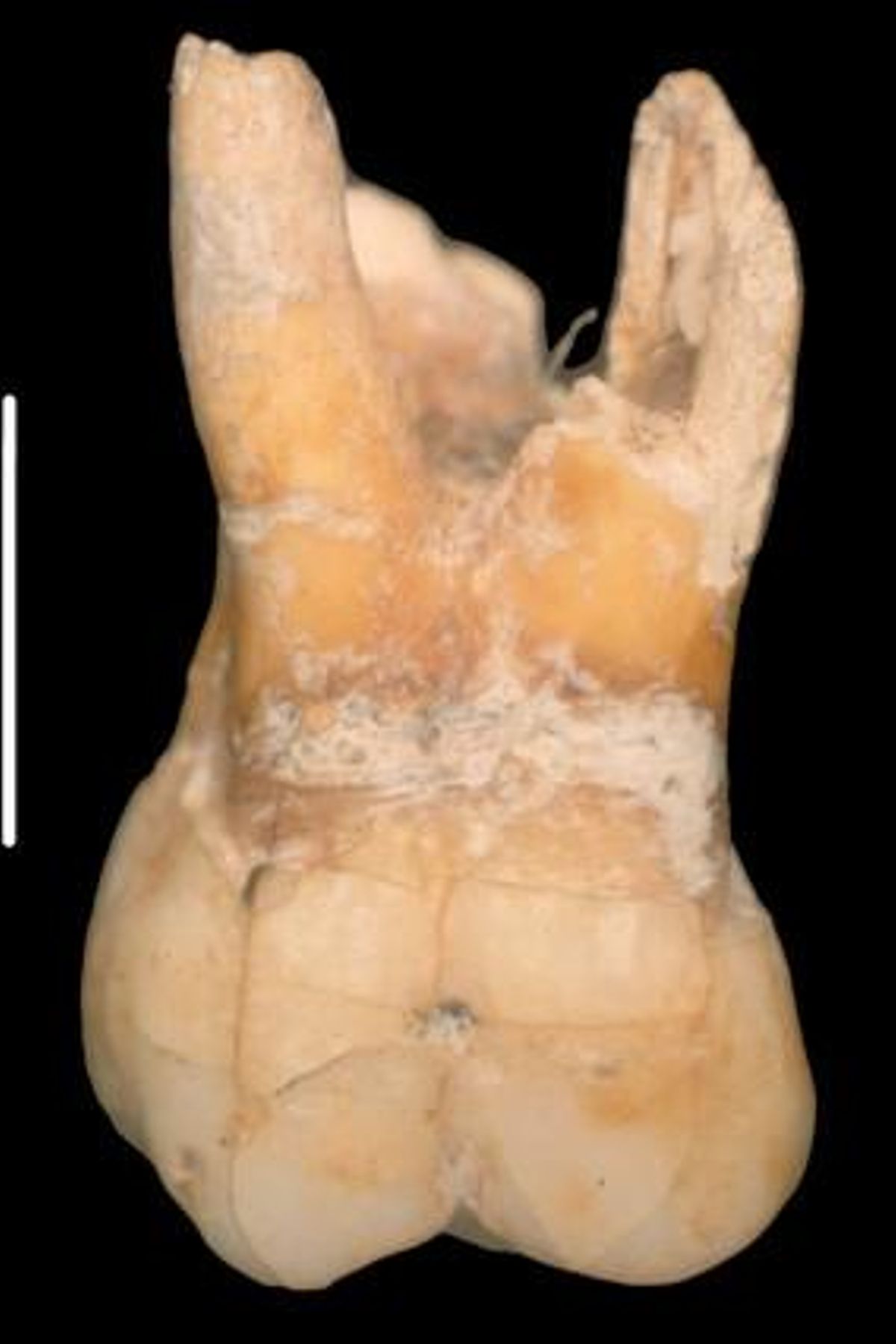 El molar del chico neandertal, de 215.000 años. El molar del chico neandertal, de 215.000 años.