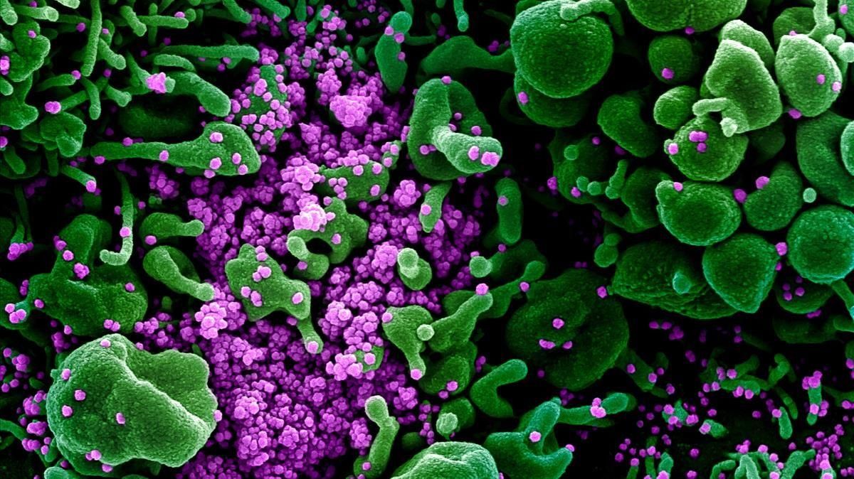 Micrografía electrónica de una célula infectada con partículas del virus SARS-COV-2. Micrografía electrónica de una célula infectada con partículas del virus SARS-COV-2.