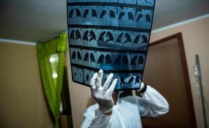 Un médico revisa radiografías de un paciente con coronavirus en un domicilio de las afueras de Lima (Perú).