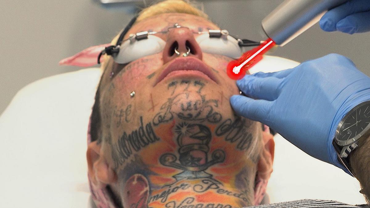 Borrón y cuenta nueva. La mujer más tatuada de Europa se borra los tatuajes de la cara.
