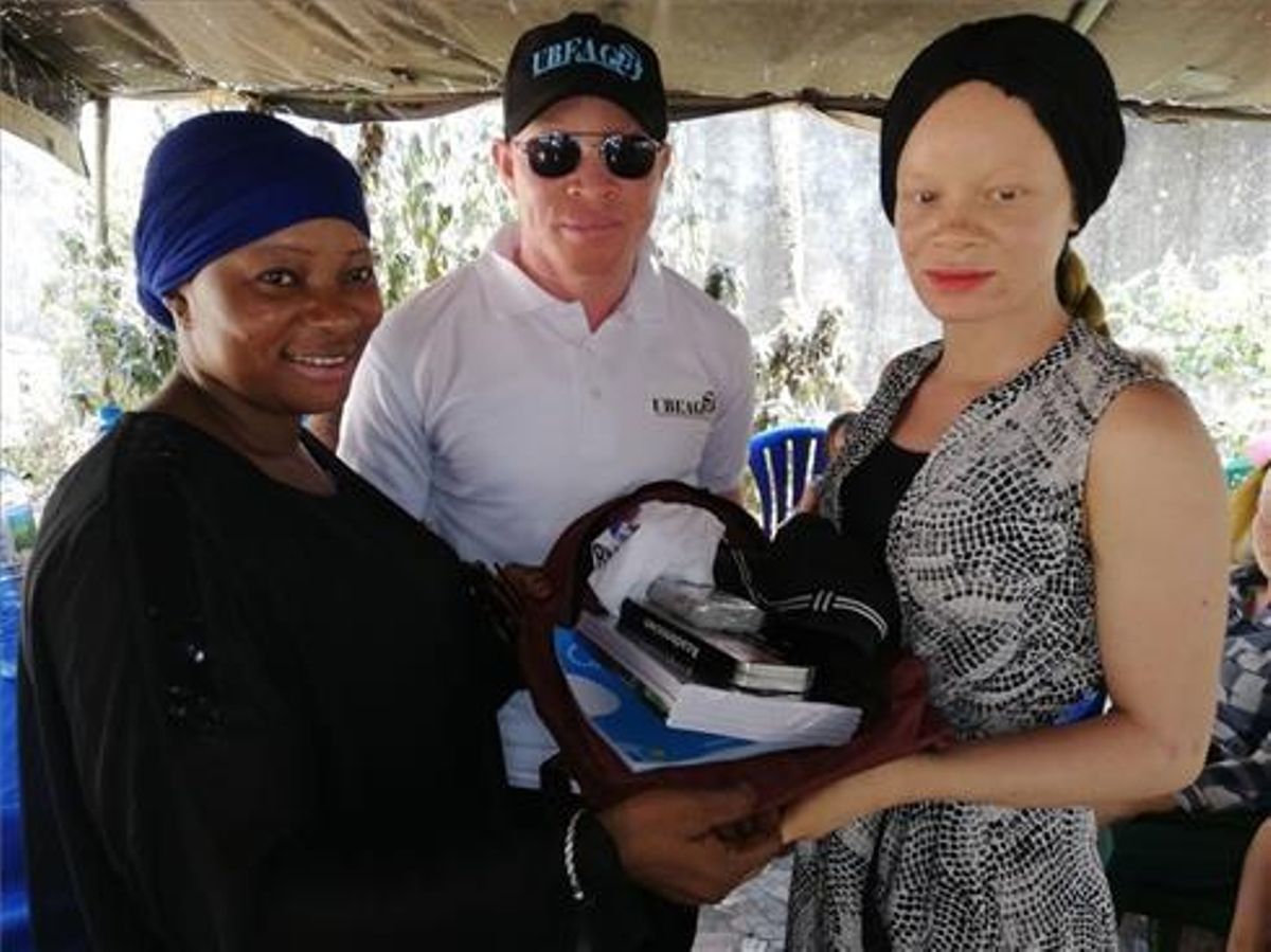 Guinea se convierte en el primer país del mundo en aprobar una ley específica para la promoción y protección de los albinos. Guinea se convierte en el primer país del mundo en aprobar una ley específica para la promoción y protección de los albinos.
