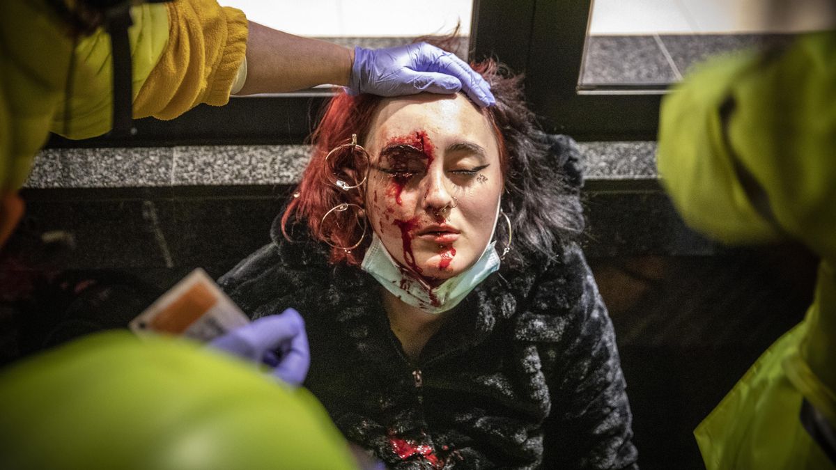 La joven herida por el proyectil de ’foam’. La joven herida por el proyectil de ’foam’.