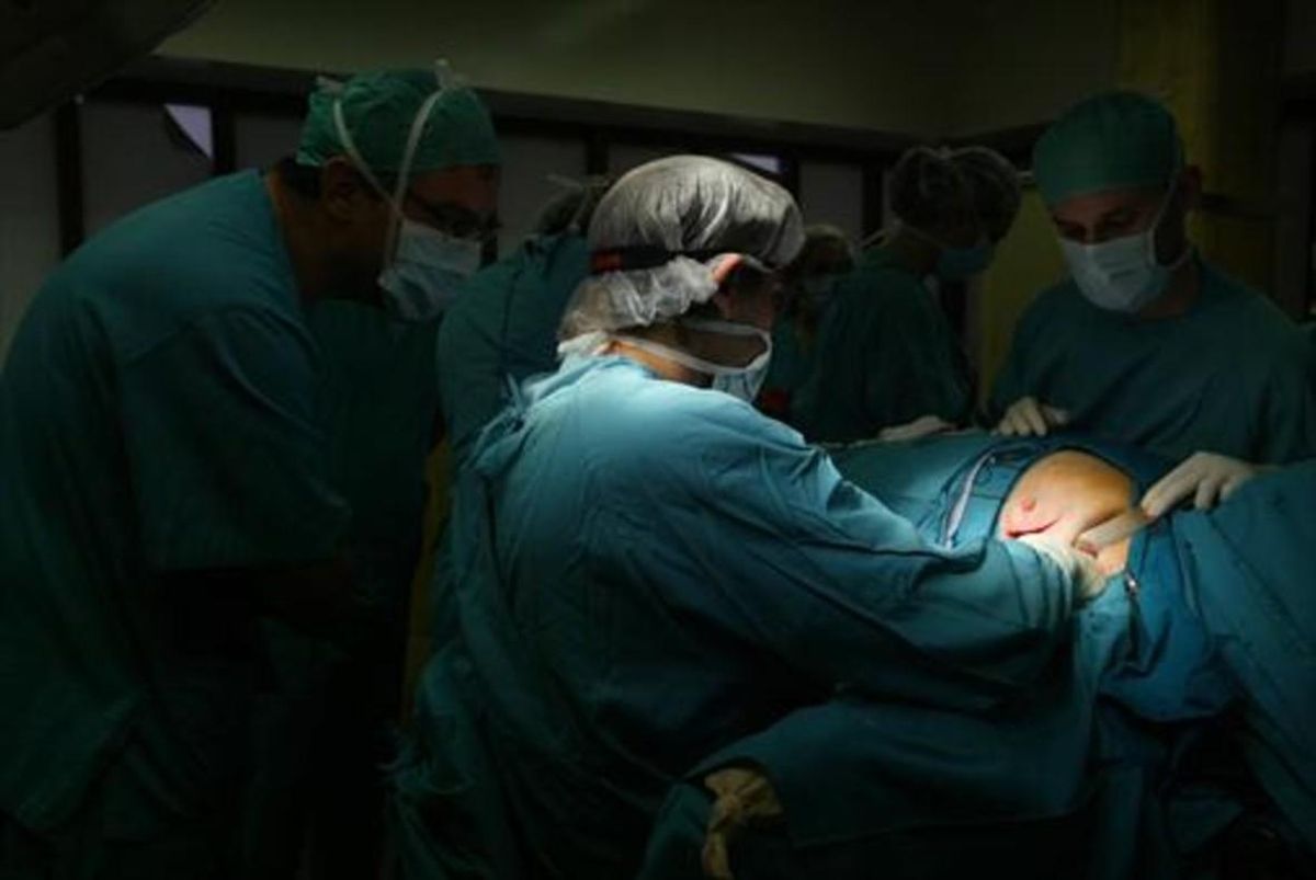 Intervención quirúrgica de cáncer en el Hospital Clínic de Barcelona. Intervención quirúrgica de cáncer en el Hospital Clínic de Barcelona.