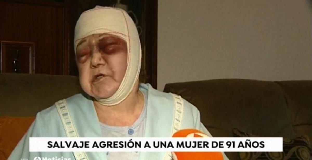 La mujer agredida, durante su intervención en ’El espejo público’, de Antena 3.