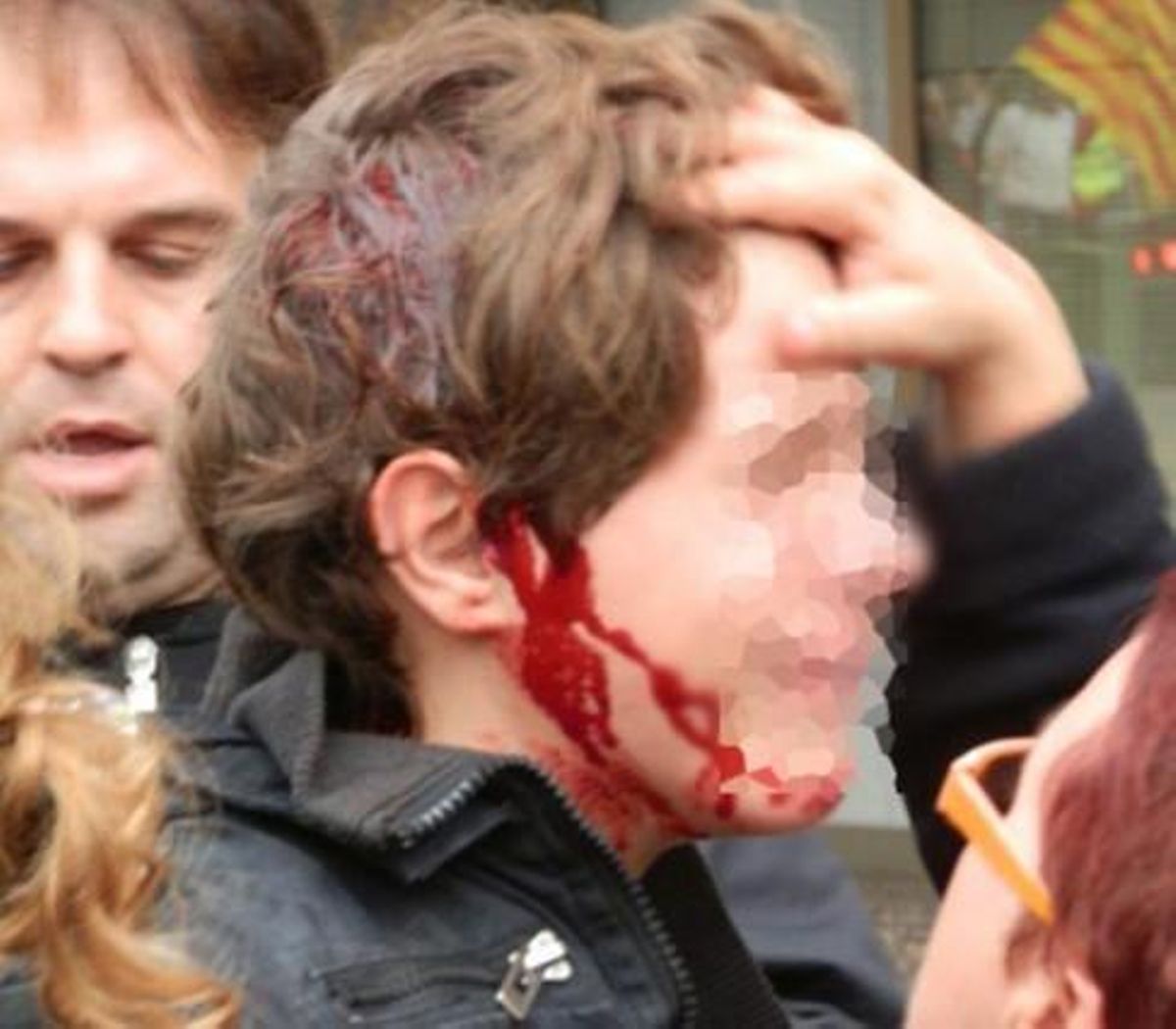 Foto del menor herido en Tarragona el pasado 14 de noviembre. Foto del menor herido en Tarragona el pasado 14 de noviembre.