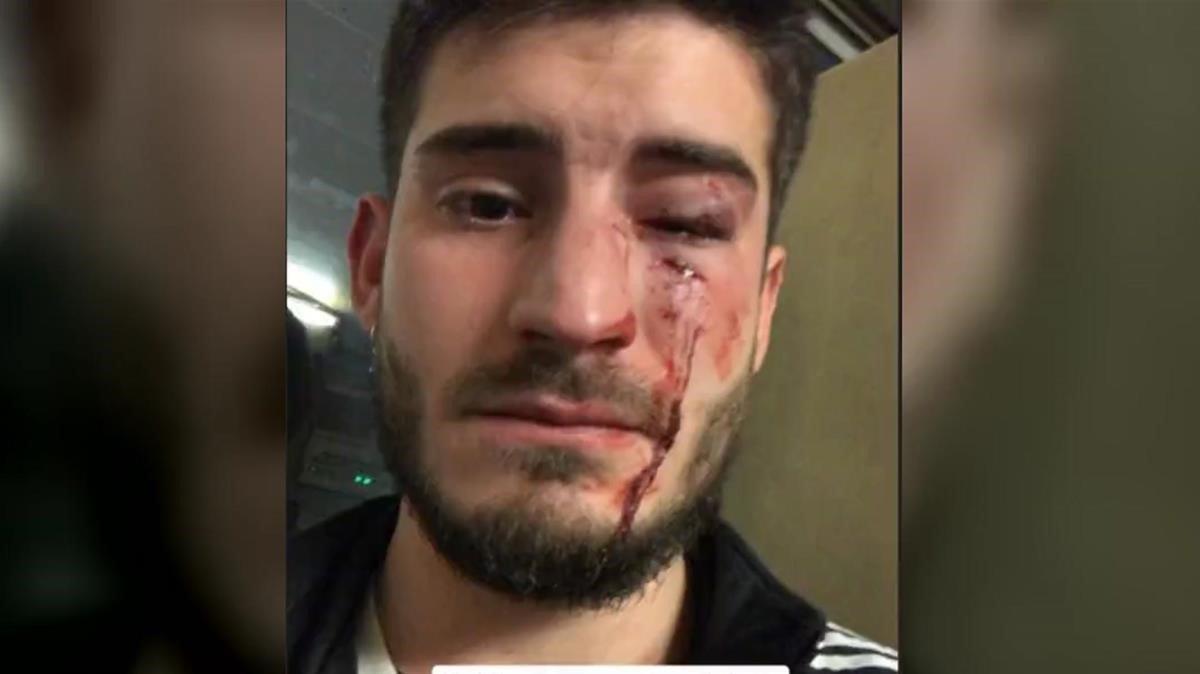 El joven que fue agredido en el metro, en una la imagen que él mismo subió a Twitter.