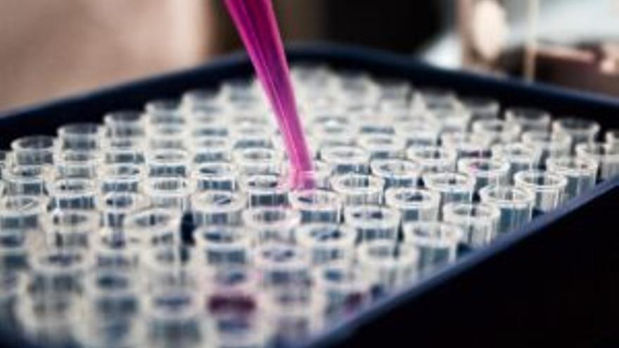 Factores externos que alteran las células favorecen la aparición de cáncer de páncreas