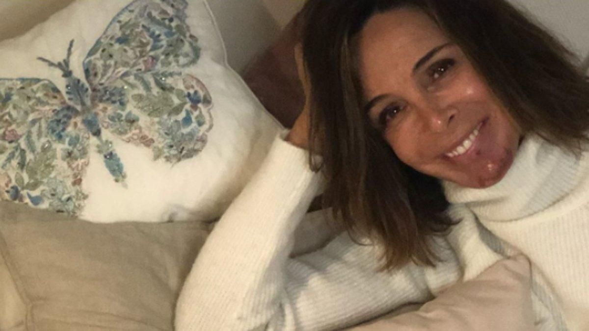 Lydia Bosch ha explicado en Instagram que padece cáncer de piel. Lydia Bosch ha explicado en Instagram que padece cáncer de piel.