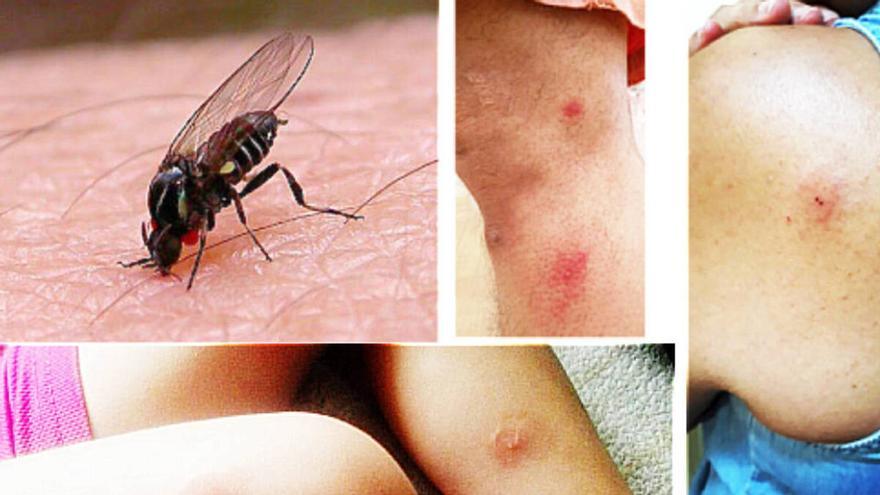 ¿Qué hacer contra la picadura de la mosca negra, que se extiende por España? - Vimarsana News