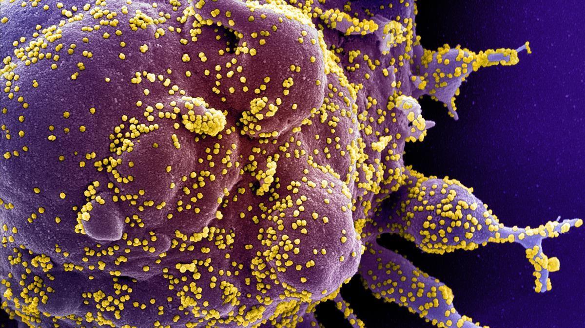 Célula humana infectada por el coronavirus.