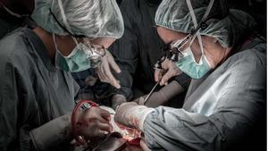 Operación de trasplante de hígado en el Hospital de la Vall d’Hebron de Barcelona.
