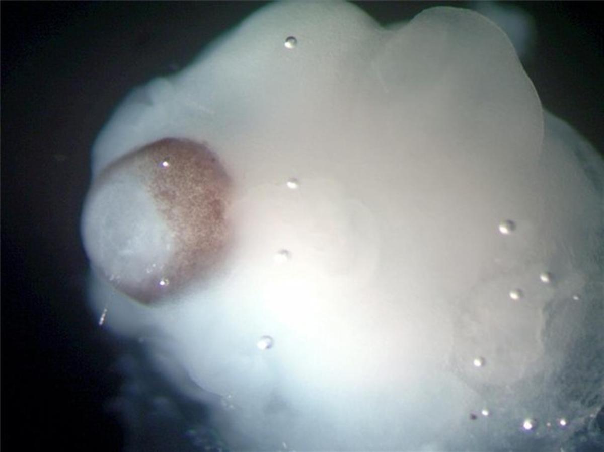 Imagen de uno de los cerebros en desarrollo creados a partir de células madre.