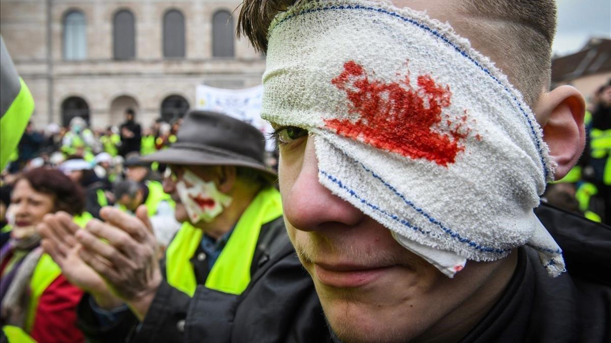 Los chalecos amarillos, con heridas falsas en los ojos, durante una manifestación.