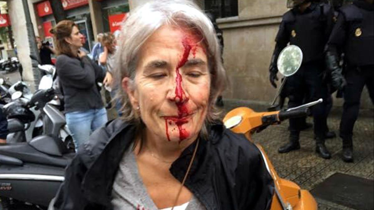 Una mujer ha resultado herida durante la carga policial en la escuela Infant Jesús de Barcelona.