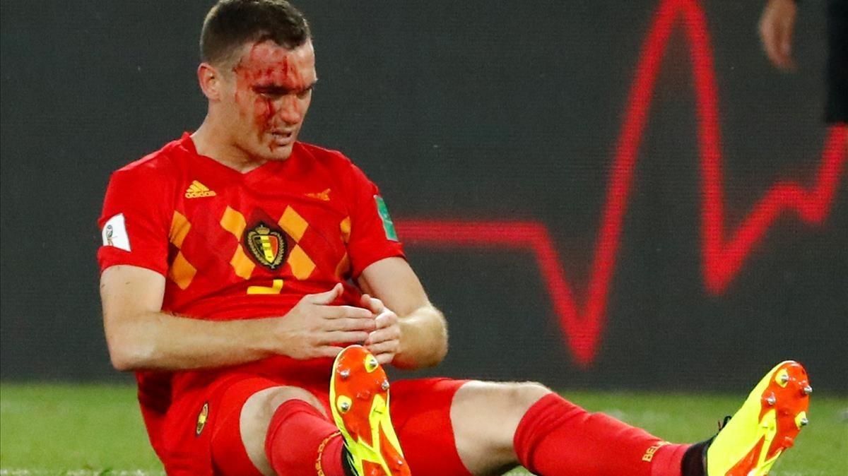 Vermaelen sangra tras una jugada en el partido ante Inglaterra. Vermaelen sangra tras una jugada en el partido ante Inglaterra.