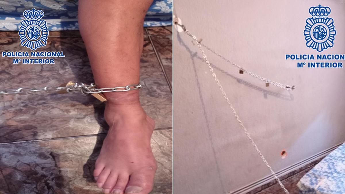 Detalles de las cadenas y del pie de una de las personas retenidas. Detalles de las cadenas y del pie de una de las personas retenidas.