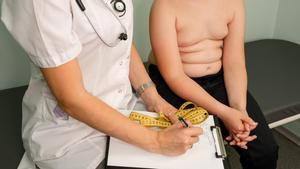 Un assaig demostra l’eficàcia d’un nou fàrmac en el tractament d’un tipus d’obesitat severa