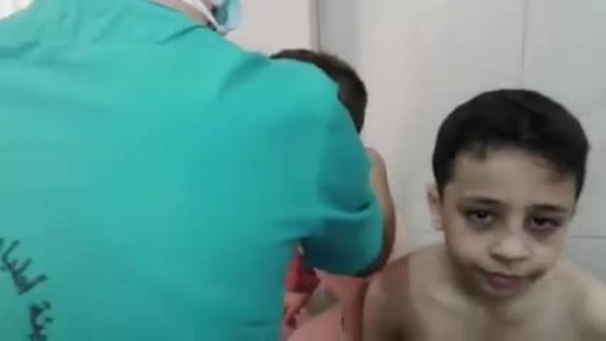 Civiles tratados de un supuesto ataque químico con gas de cloro en Alepo.