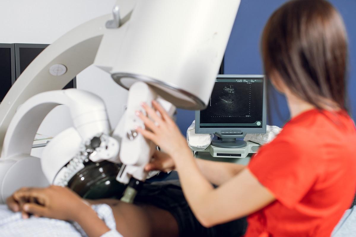 ¿Qué es una litotricia extracorpórea? ¿Qué es una litotricia extracorpórea?