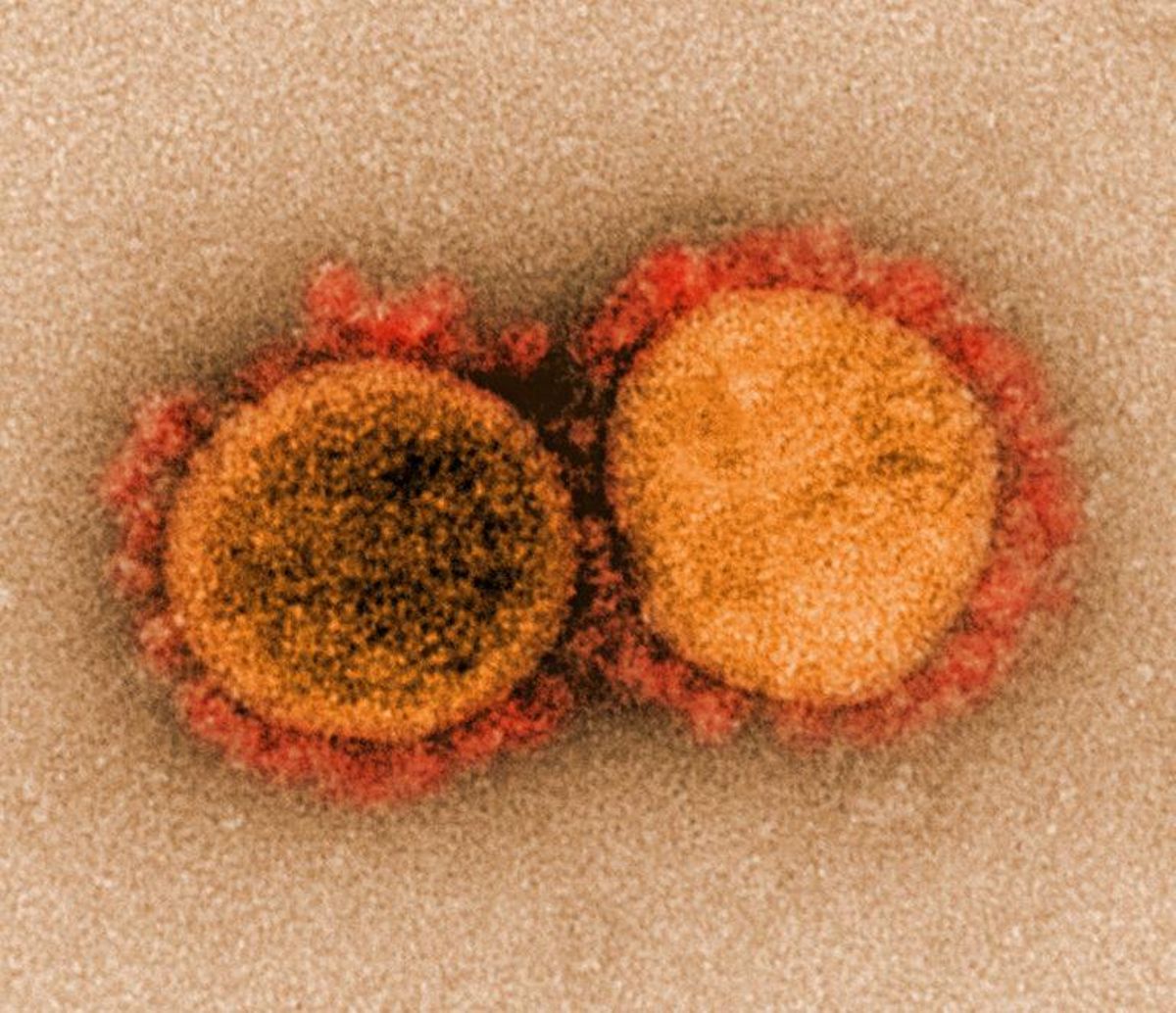 Los «secretos» de la variante Delta: es un «monstruo» al lado del coronavirus de Wuhan Los «secretos» de la variante Delta: es un «monstruo» al lado del coronavirus de Wuhan