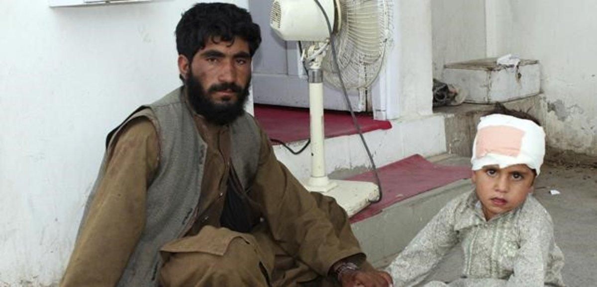 Niño herido en el atentado en el mercado del distrito de Helmand en Afganistán. Niño herido en el atentado en el mercado del distrito de Helmand en Afganistán.