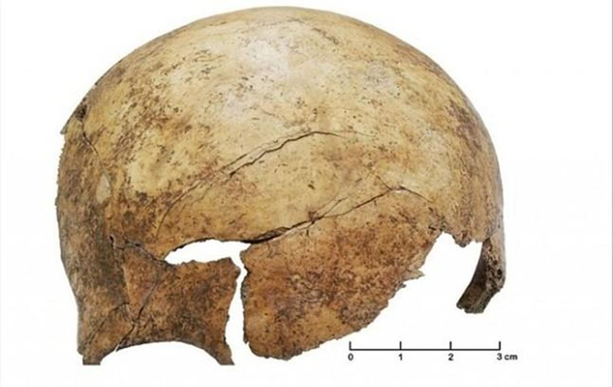 Cráneo de un niño encontrado en el yacimiento paleolítico de Schöneck-Kilianstädten, en Alemania, con restos evidentes de haber sido golpeado violentamente. Cráneo de un niño encontrado en el yacimiento paleolítico de Schöneck-Kilianstädten, en Alemania, con restos evidentes de haber sido golpeado violentamente.