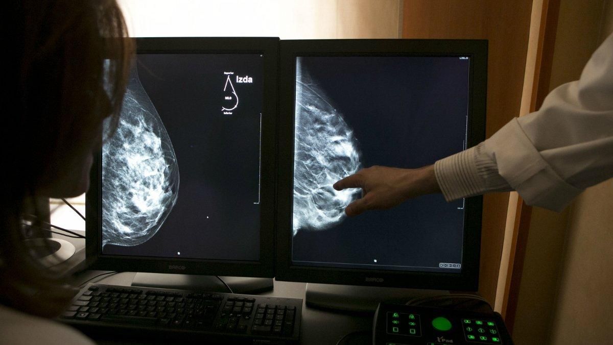 Imagen de archivo de una mamografía en 3D, que permite mejorar la detección del cáncer de mama. Imagen de archivo de una mamografía en 3D, que permite mejorar la detección del cáncer de mama.