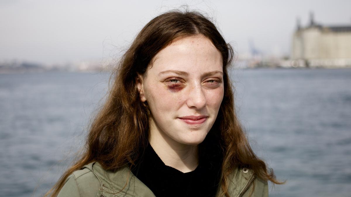 La estudiante Misra Sapan recibió un rodillazo de la policía turca en el ojo al ser arrestada en una protesta estudiantil. 