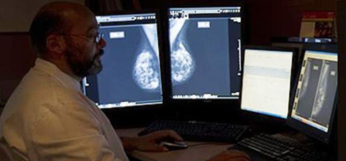 Un especialista analiza mamografías digitales en el Hospital del Mar. Un especialista analiza mamografías digitales en el Hospital del Mar.