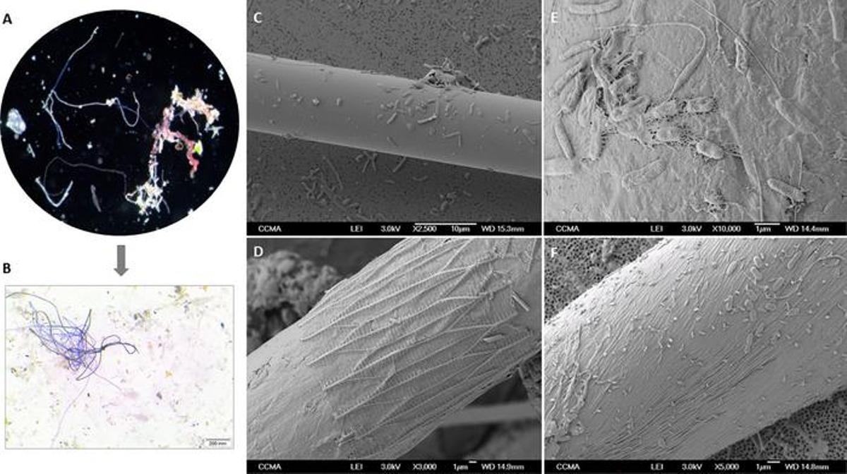 Muestras de microplásticas analizadas en el estudio, en las que se pueden observar varias colonias de bacterias. 