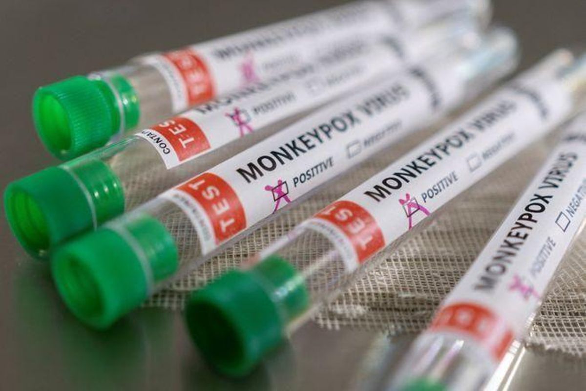 Madrid eleva a 72 los casos confirmados de viruela del mono y estudia 38 más como sospechosos Madrid eleva a 72 los casos confirmados de viruela del mono y estudia 38 más como sospechosos
