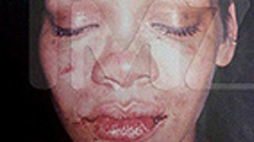 Una Foto Muestra Cómo Quedó Rihanna Tras La Paliza Que Le Propinó Chris Brown 