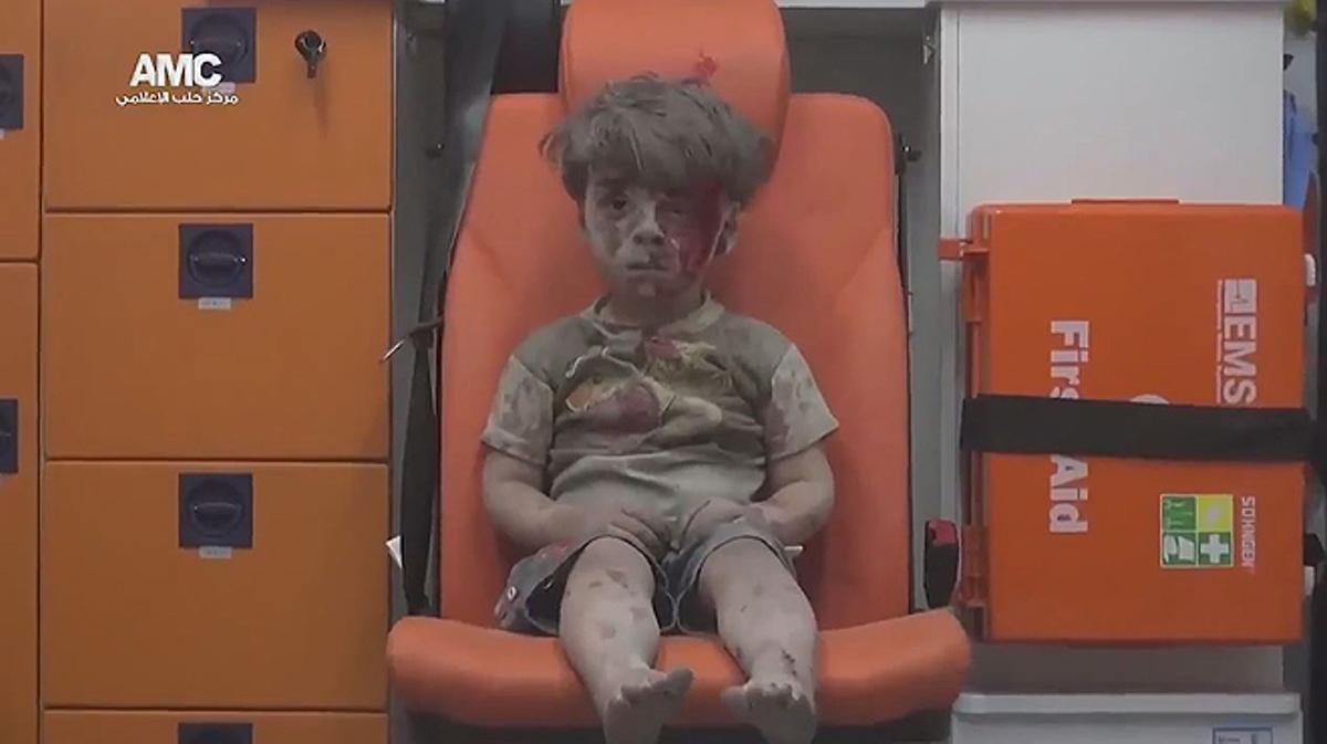 Un niño sirio que sobrevive a un bombardeo aguarda en una ambulancia.