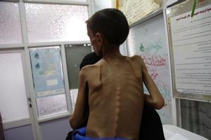 La guerra del Iemen ha causat més de 10.200 nens morts o ferits