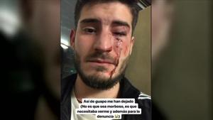 Un jove pateix una salvatge agressió homòfoba al metro de Barcelona