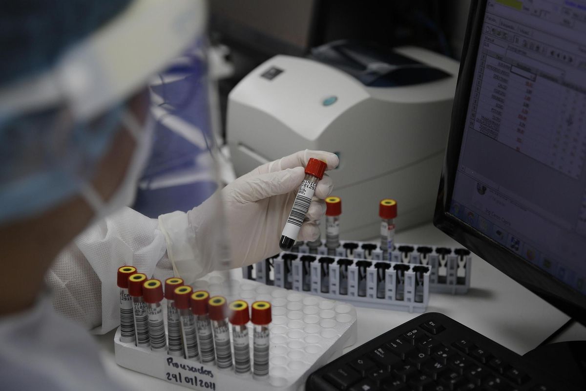 Imagen de archivo de un laboratorista que analiza muestras de sangre. EFE/Rodrigo Sura Imagen de archivo de un laboratorista que analiza muestras de sangre. EFE/Rodrigo Sura