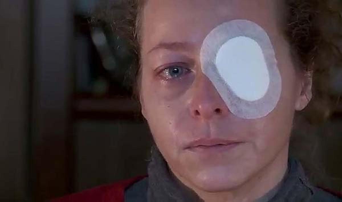Ester Quintana, de 42 años, perdió un ojo por un proyectil durante la manifestación del 14-N.