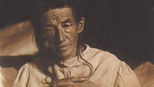 La paciente Auguste Deter, en una imagen de 1902 de la historia clínica elaborada por Alois Alzheimer.