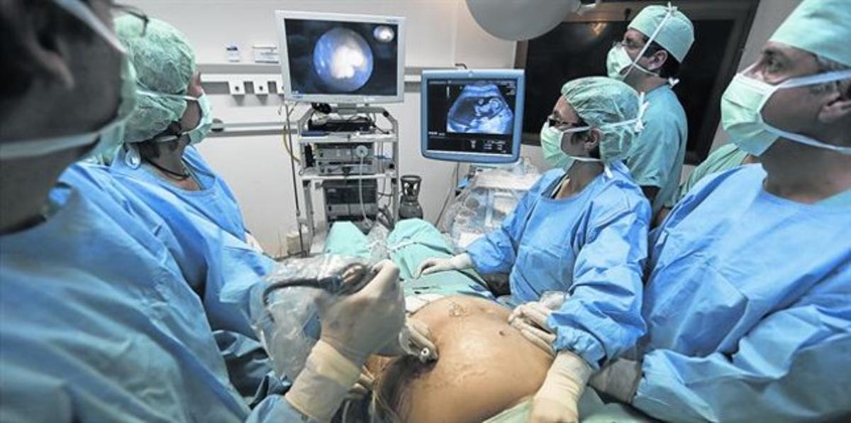 EN EL QUIRÓFANOOperación de un feto realizadapor el doctor Gratacós el pasado19 de diciembre en la Maternitat.