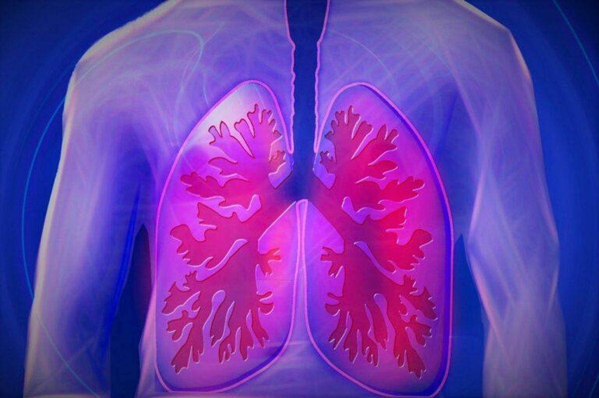 ¿Qué es la hipertensión arterial pulmonar? ¿Qué es la hipertensión arterial pulmonar?