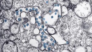 Investigadores del CSIC obtienen un nanomaterial que elimina el coronavirus y es aplicable en mascarillas y tejidos.