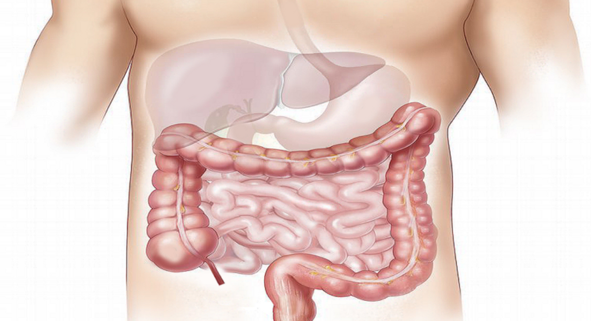 ¿Qué es el hígado graso? ¿Se puede prevenir? ¿Qué es el hígado graso? ¿Se puede prevenir?