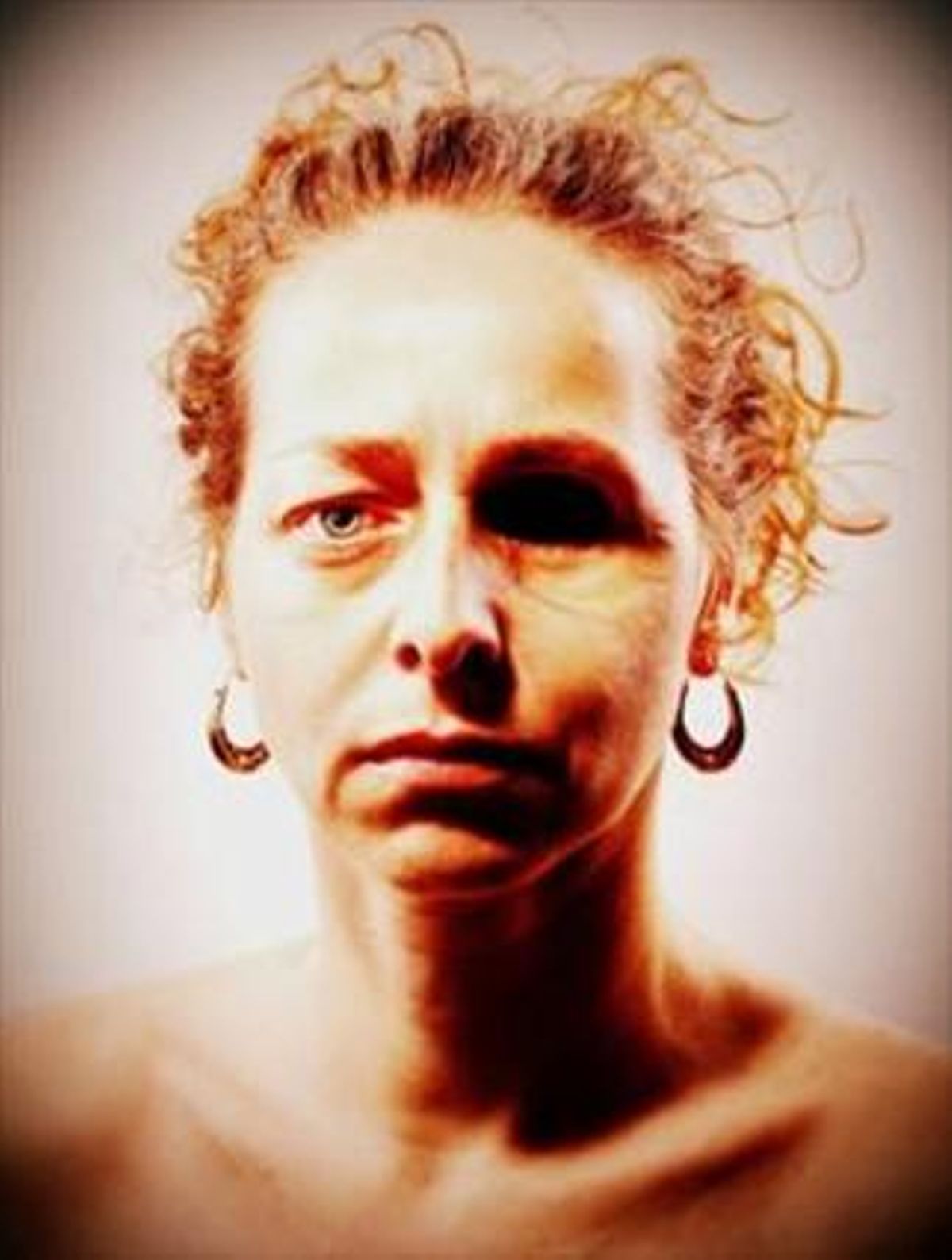 Ester Quintana colgó en su Facebook una foto de su cara en la que aparece sin parche en el ojo. Ester Quintana colgó en su Facebook una foto de su cara en la que aparece sin parche en el ojo.