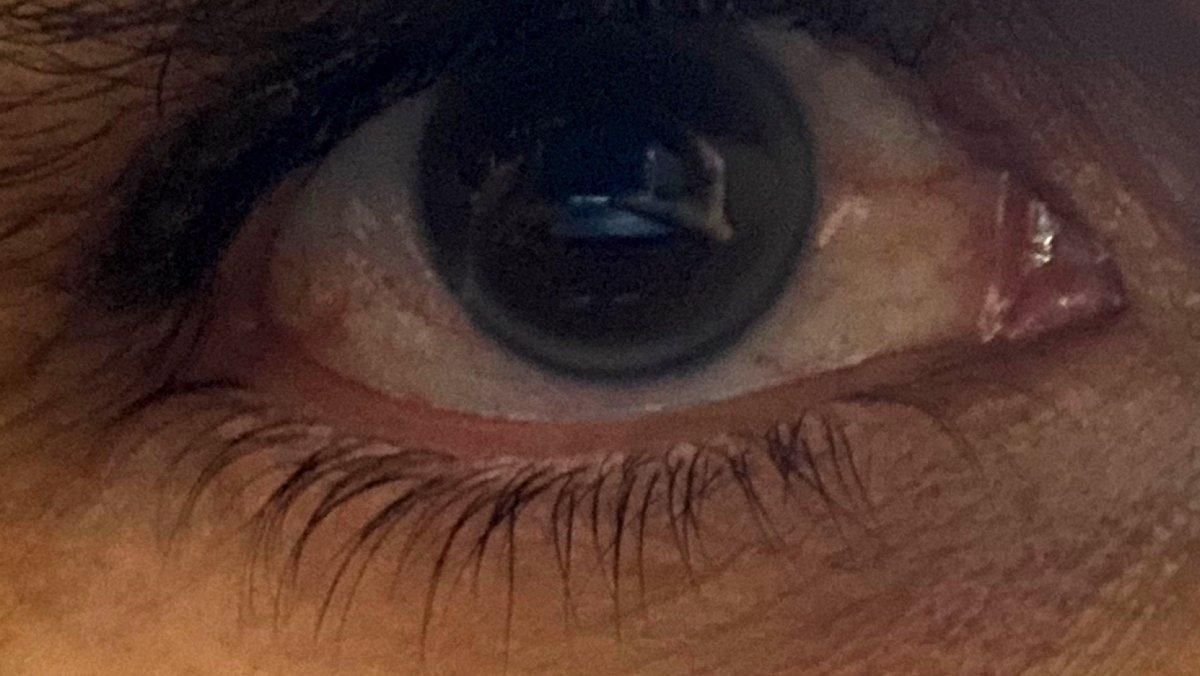 Un ojo. Un ojo.